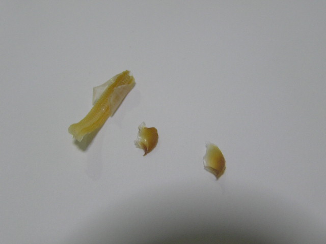Radula string and jaws Radula string and jaws