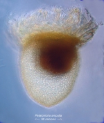 Petalotricha ampulla 
