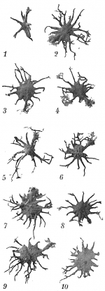 Astrorhiza limicola