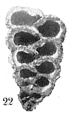 Dorothia pseudoturris Dorothia pseudoturris