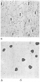 Chromista - Foraminifera (foraminifers)