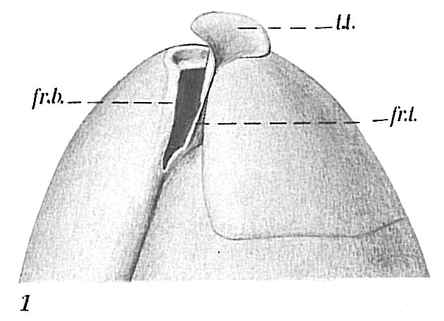 Globobulimina sp.