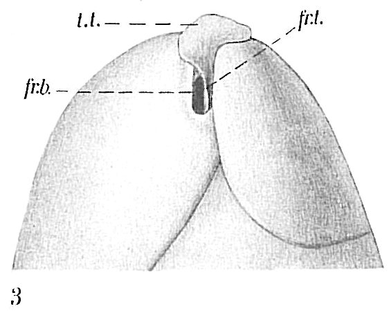 Globobulimina sp.