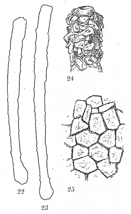 Hyperammina elongata Hyperammina elongata