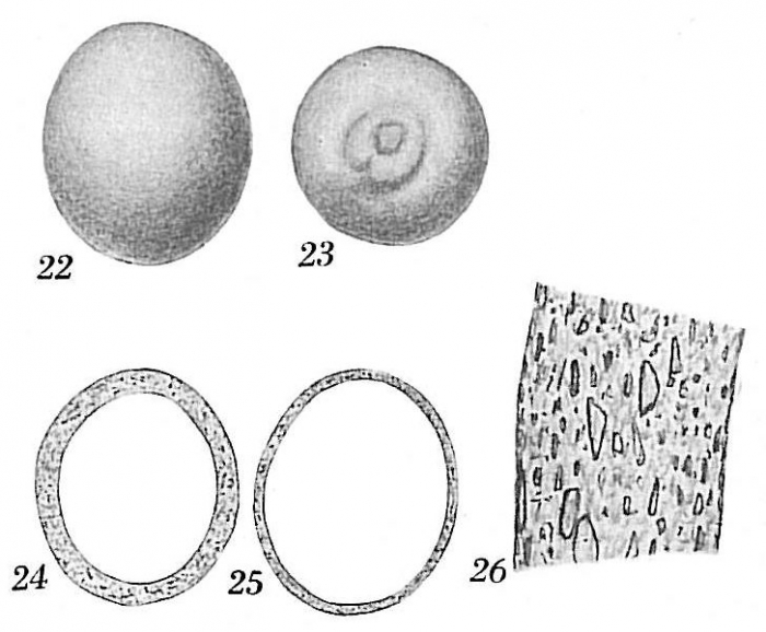 Thurammina sphaerica Thurammina sphaerica
