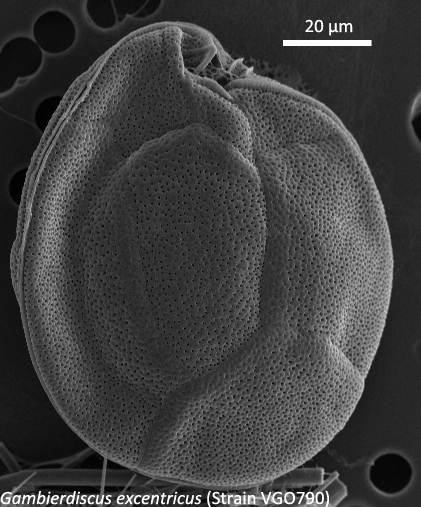 Gambierdiscus excentricus Gambierdiscus excentricus