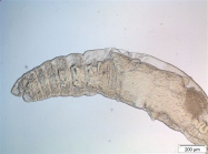 Tubificoides heterochaetus anterior part