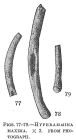 Hyperammina maxima