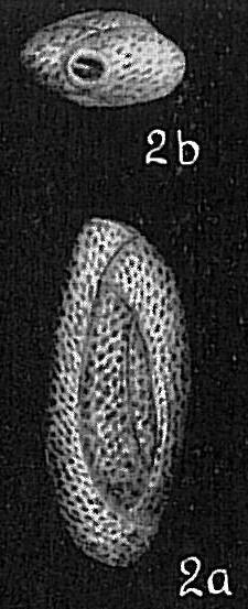 Quinqueloculina semireticulosa Quinqueloculina semireticulosa