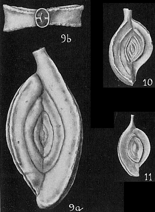 Spiroloculina grateloupi