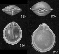 Chromista - Foraminifera (foraminifers)