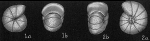 Chromista - Foraminifera (foraminifers)