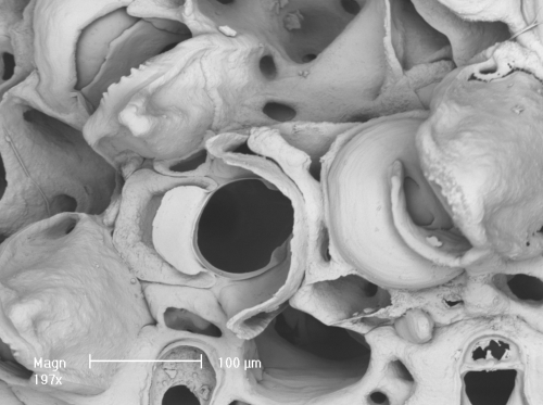 Osthimosia glomerata - zooids and ovicells