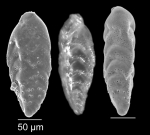 Chromista - Foraminifera (foraminifers)