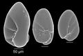 Chromista - Foraminifera (foraminifers)