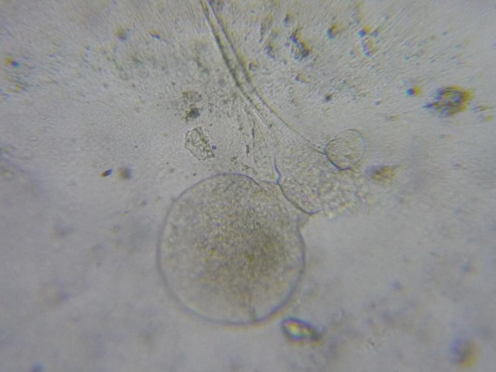 Hypophorella expansa Hypophorella expansa