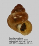 Skenella umbilicata