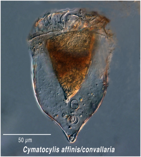 Cymatocylis convallaria/affinis