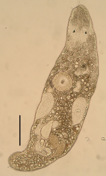 Ceratopera gracilis (Trigonostomidae, Dalytyphloplanida, Rhabdocoela, Platyhelminthes Ceratopera gracilis (Trigonostomidae, Dalytyphloplanida, Rhabdocoela, Platyhelminthes