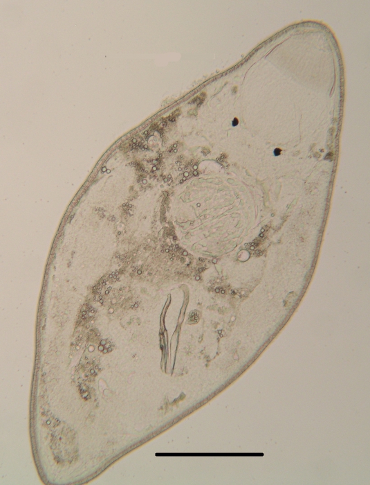 New species of Rogneda (Polycystididae, Kalyptorhynchia, Rhabdocoela, Platyhelminthes)
