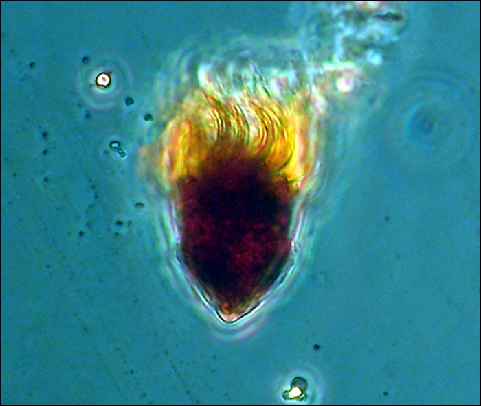 Oligotrich Ciliate Oligotrich Ciliate