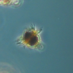 Mesodinium rubrum, a photosynthetic ciliate 
