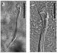 Platyhelminthes (flatworms)