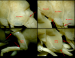 Stegocephalopsis ampulla (some details of morphology)