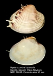 Hysteroconcha lupanaria
