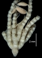 Echinodermata (echinoderms)