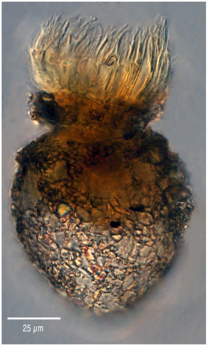 Stenosomella ventricosa Stenosomella ventricosa