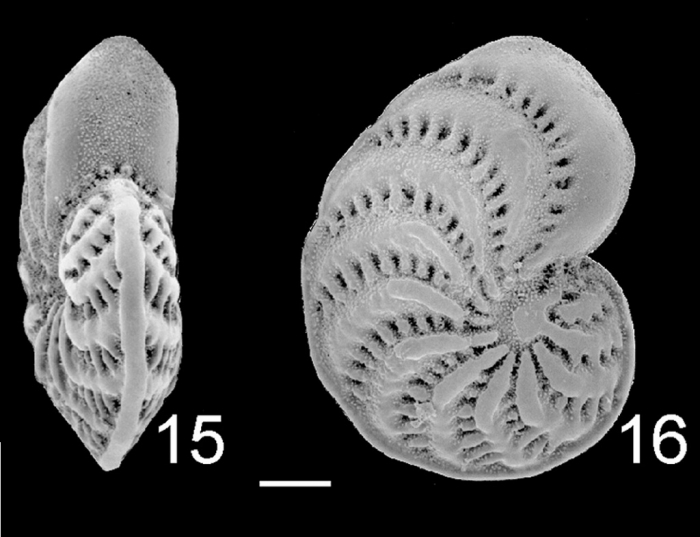 Elphidium advenum tongaense Elphidium advenum tongaense
