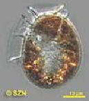 Dinophysis ovum Dinophysis ovum