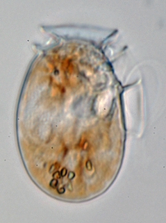 Dinophysis ovum Dinophysis ovum