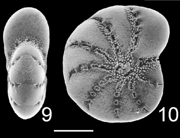 Elphidium excavatum s.s. NZ