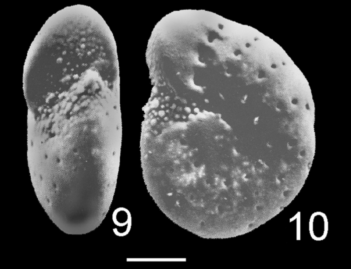 Elphidium sydneyense HOLOTYPE