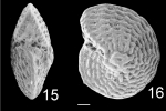 Chromista - Foraminifera (foraminifers)