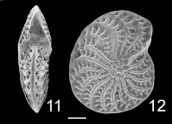 Elphidium owenianum (d'Orbigny, 1839) Australia