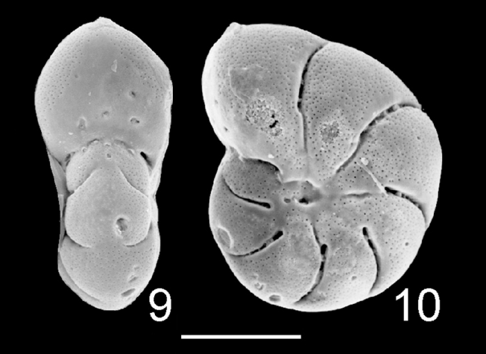 Elphidium sandiegoense Australia Elphidium sandiegoense Australia