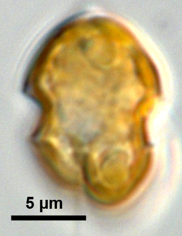 Azadinium poporum Azadinium poporum
