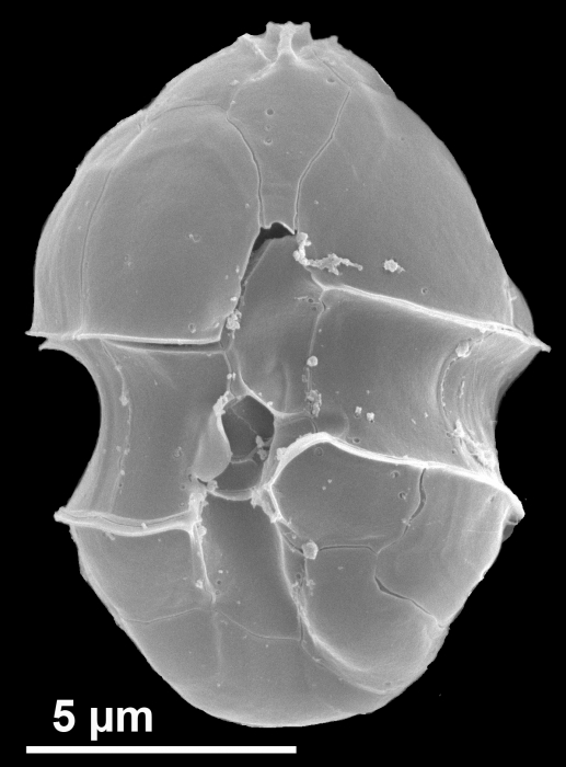 Azadinium poporum Azadinium poporum