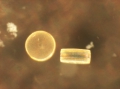 Chromista - Bacillariophyceae (diatoms)