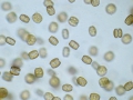 Chromista - Bacillariophyceae (diatoms)