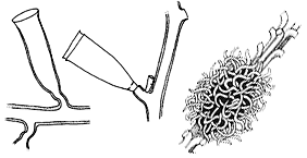 Family Lafoeidae, two hydrothecae and characteristic aggregates of gonothecae (coppinia)