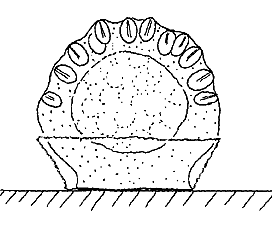Family Microhydrulidae: longitudinal section through polyp (microscopic)