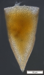 Cyttarocylis cassis - a morph of Cyttarocylis ampulla