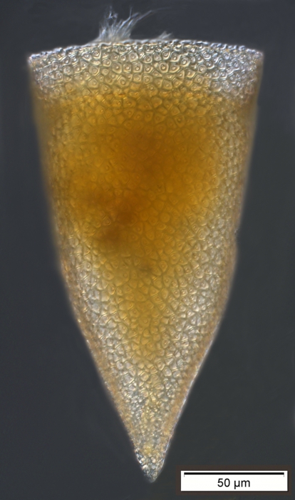 Cyttarocylis cassis - a morph of Cyttarocylis ampulla Cyttarocylis cassis - a morph of Cyttarocylis ampulla