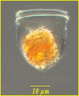 Ascampbelliella tortulata (Jorgendsen 1924)