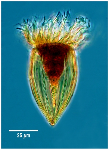 Protorhabdonella simplex