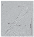 Platyhelminthes (flatworms)